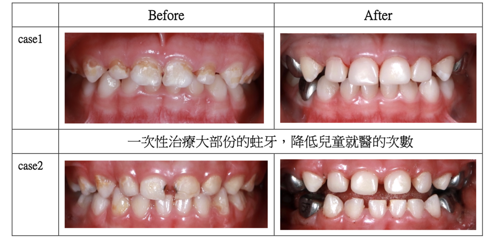 「兒童牙科」孩子害怕看牙怎麼辦？