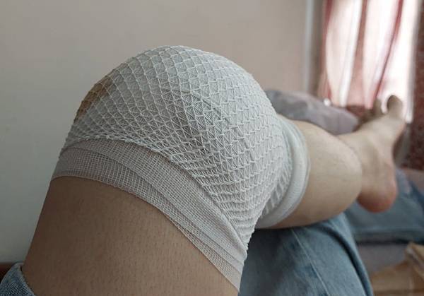膝關節疼痛 肩關節疼痛 為什麼？ Knee pain Sho