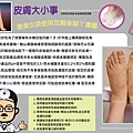 【皮膚大小事】愛美女孩使用足膜後腳丫潰瘍