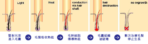 毛囊生長週期-醫美診所推薦