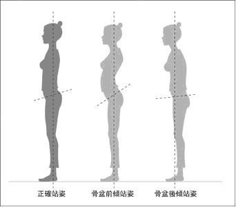 骨盆位置