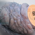 包皮回收.jpg