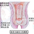 切口選擇.jpg