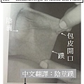 引用-蹼.jpg
