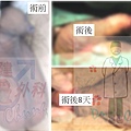 術後.jpg
