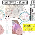 個案.jpg