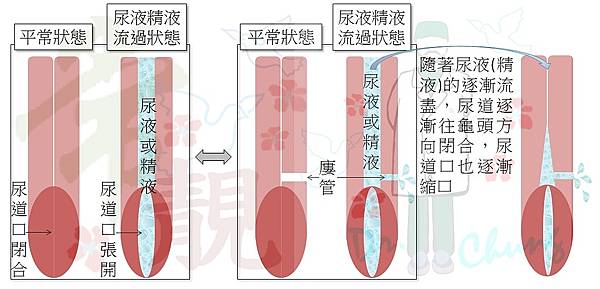 正常VS廔管.jpg