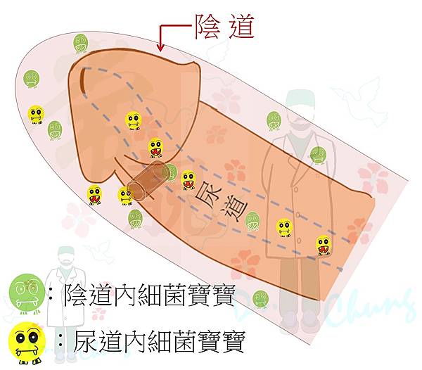 尿道廔管-性行為.jpg