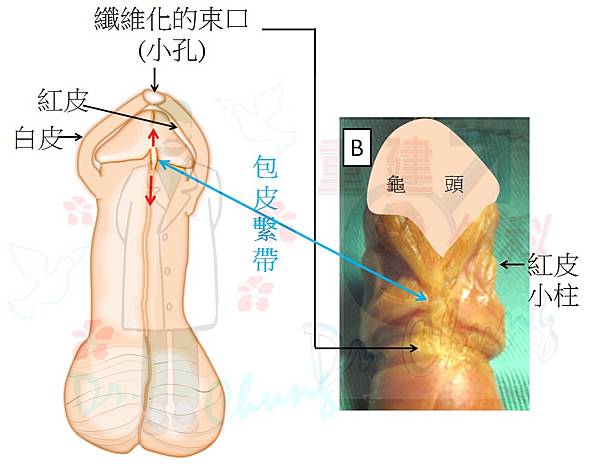 包皮繫帶的神經敏感問題探討(The hypersensiti