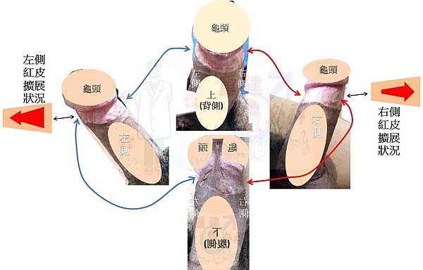 個案C-7.jpg