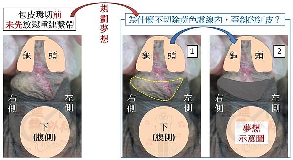 個案C-9.jpg