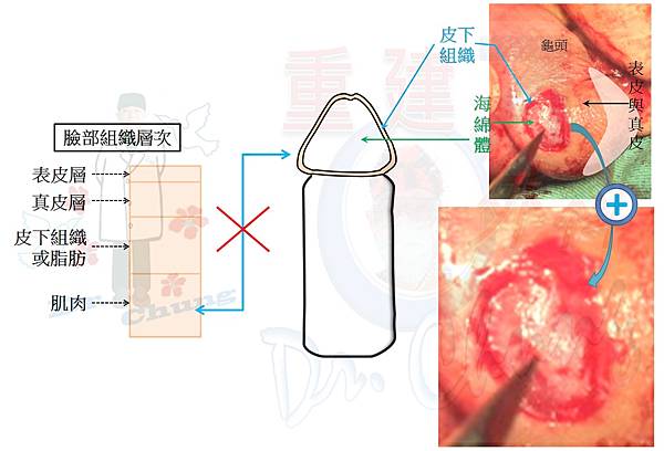 龜頭組織層次.jpg