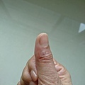 thumb