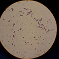 Gram positive（表皮葡萄球菌）