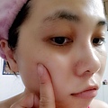 7淡斑精華.jpg