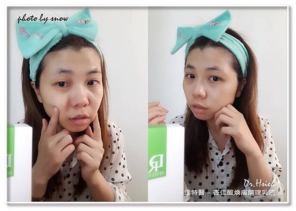 107.03.27Dr.Hsieh達特醫 - 杏仁酸煥膚調理乳液-橫式-4.jpg