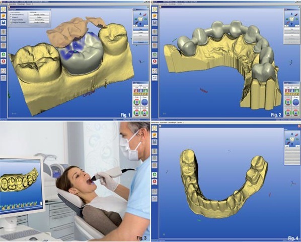 Dental-3D-printing.jpg