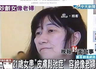 21歲容貌如60歲老嫗.jpg 21歲容貌如60歲老嫗.jpg