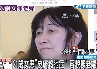 21歲容貌如60歲老嫗.jpg