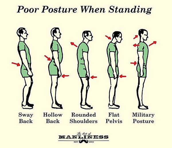 Poor-Posture-Standing-2.jpg
