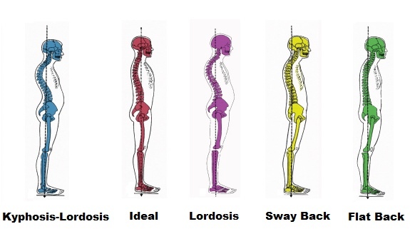 spine-alignments.jpg