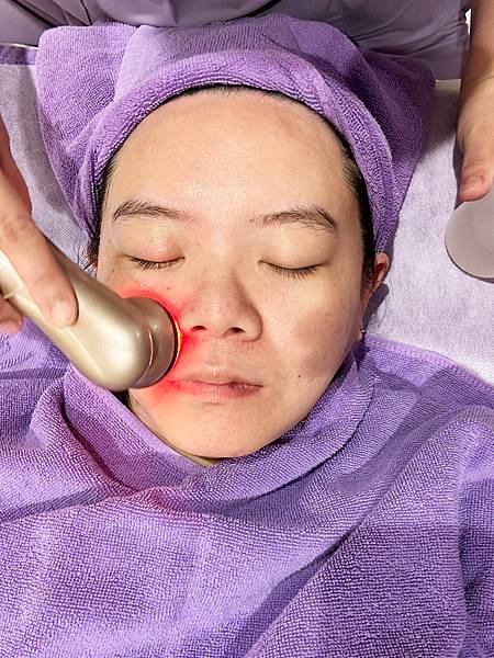 【醫美】除斑細緻毛孔推薦～台北愛爾麗診所分享-蜂巢皮秒心得分