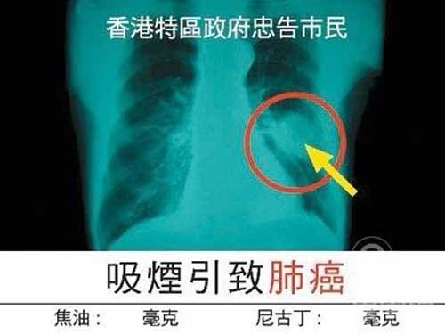 香菸，大多數人都知道尼古丁危害肺部健康，原來最毒竟然是...3