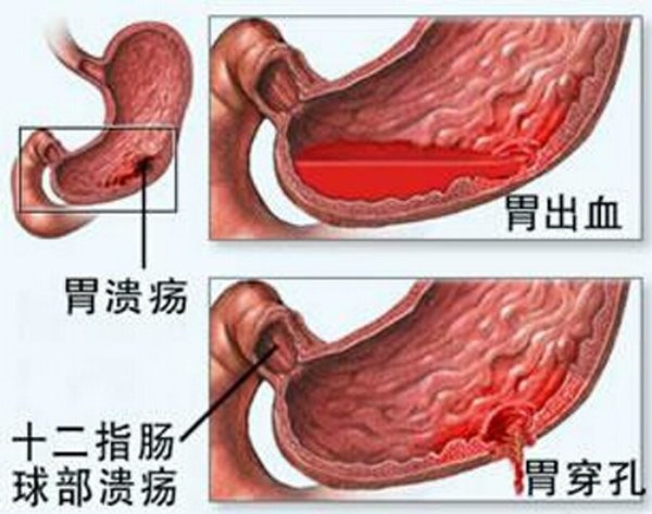 胃不好，人生就黑白！下面教你怎麼養胃 ~