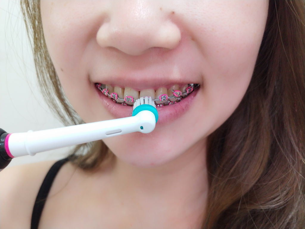 清潔 電動牙刷評測 2020年電動牙刷推薦 歐樂b電動牙刷genius X 連超難刷的矯正人都能潔淨無死角 苺 Blog 部落格 Fashionguide