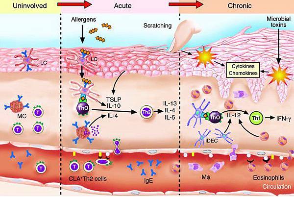 atopicPhase atopicPhase