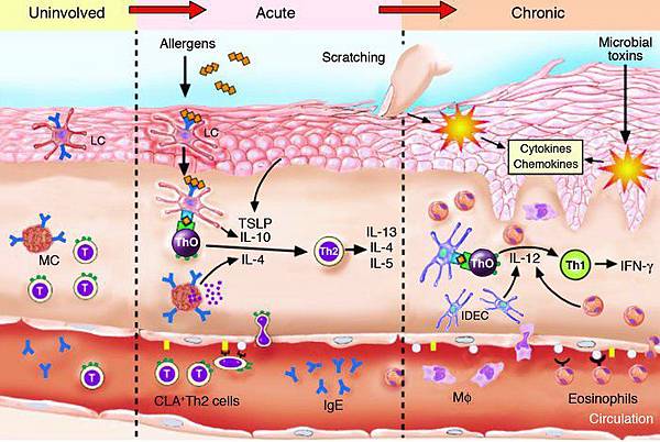 atopicPhase