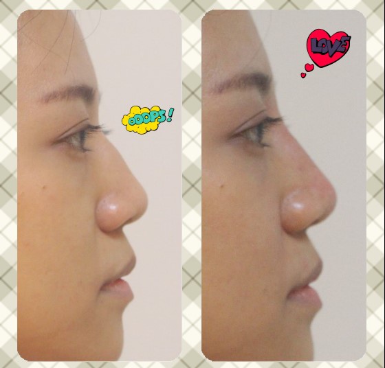 PM PM