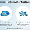 CoolSculpting-Process.jpg