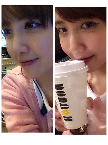 晶亮瓷隆鼻 12.jpg 晶亮瓷隆鼻 12.jpg