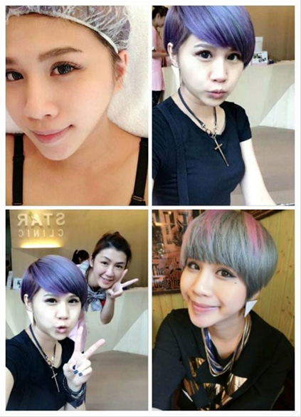 台中醫美星和診所_杏仁酸煥膚_Albee、Kandy、唐筠喬01 台中醫美星和診所_杏仁酸煥膚_Albee、Kandy、唐筠喬01