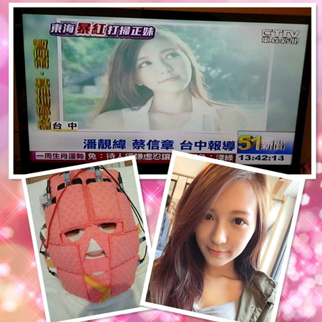 台中醫美星和診所_杏仁酸煥膚_Albee、Kandy、唐筠喬03 台中醫美星和診所_杏仁酸煥膚_Albee、Kandy、唐筠喬03