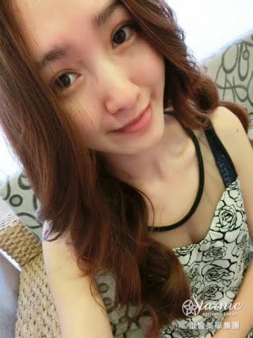 星和高雄_雙眼皮(縫)_賴衍翰院長09 星和高雄_雙眼皮(縫)_賴衍翰院長09