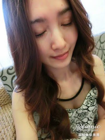 星和高雄_雙眼皮(縫)_賴衍翰院長10 星和高雄_雙眼皮(縫)_賴衍翰院長10