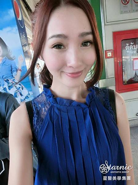 星和高雄_雙眼皮(縫)_賴衍翰院長12 星和高雄_雙眼皮(縫)_賴衍翰院長12