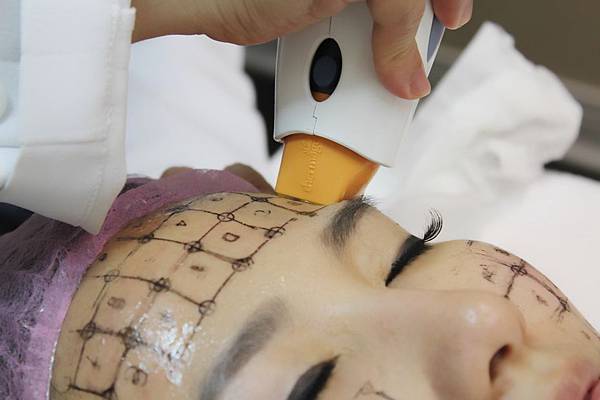 星采大安_電波拉皮_玩美miss蜜07 星采大安_電波拉皮_玩美miss蜜07