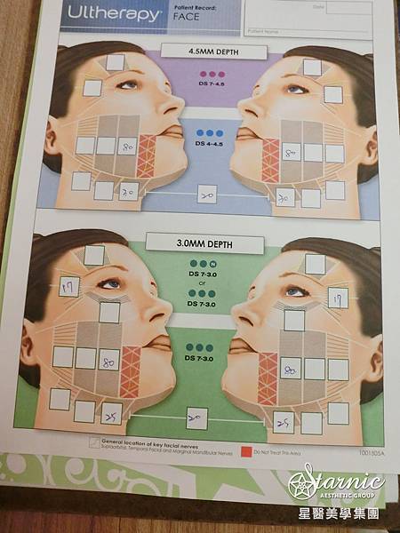星和台中_極線音波拉提_喬喬媽咪20