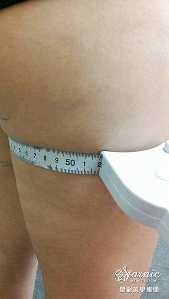 星和台中_歐萃學超音波系統(標靶震波)_Mika12 星和台中_歐萃學超音波系統(標靶震波)_Mika12