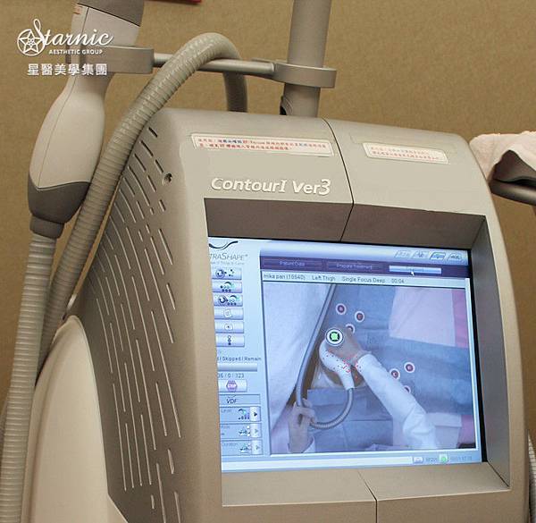 星和台中_歐萃學超音波系統(標靶震波)_Mika18 星和台中_歐萃學超音波系統(標靶震波)_Mika18