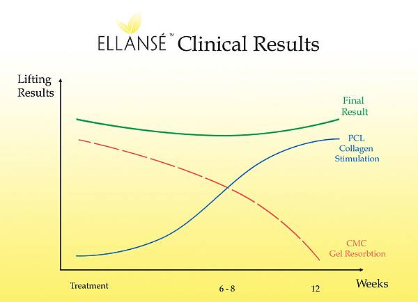 Ellanse洢蓮絲的CMC凝膠體會隨著時間被身體「代謝」失去其支撐塑形效果；PCL微晶球粒子則會隨時間被身體「吸收」刺激自體增生的膠原蛋白漸漸填補原來晶球的空間，接續其支撐效果。