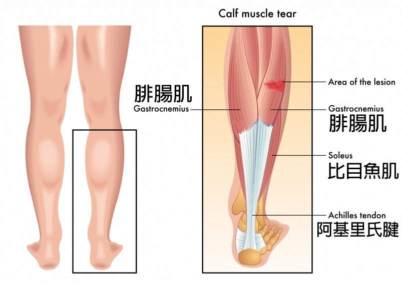 【星媺整所】小腿腓腸肌位置