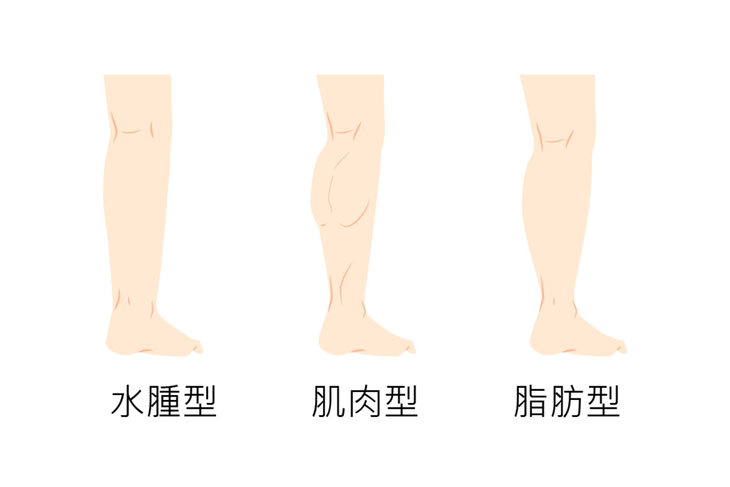 【星媺整所】肌肉型腿粗