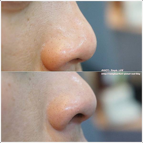 Pores.jpg Pores.jpg