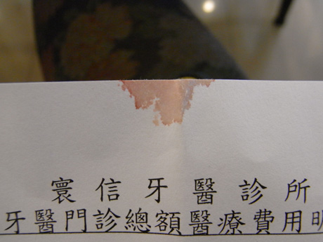 沾到血