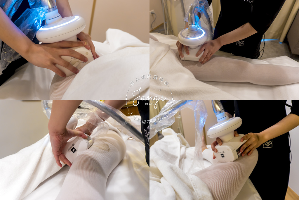 美體雕塑LPG課程讓我SIZE偷偷小一號！(美容美體／緊緻曲