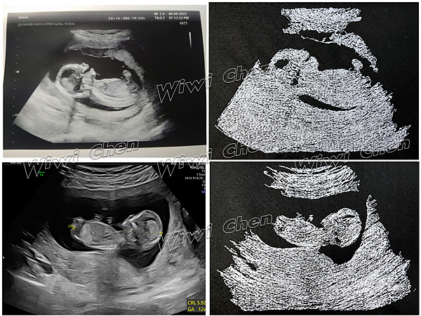 投影片3 投影片3